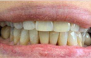 Dental Aesthetics | Dental Cleanings, Dentures and Teeth Whitening