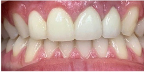 Dental Aesthetics | Cosmetic Dentistry, Dental Cleanings and Teeth Whitening