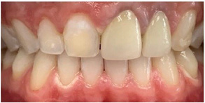 Dental Aesthetics | Night Guards, TMJ Disorders and Laser Dentistry