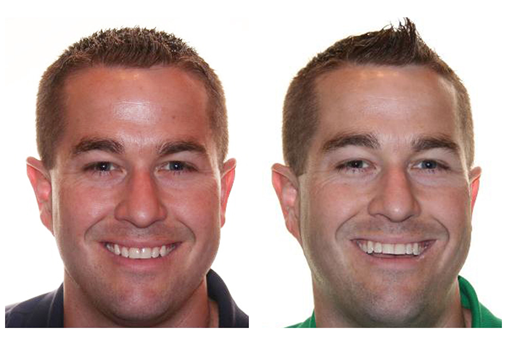 Dental Aesthetics Before & After Photos Implant Dentistry, Oral Cancer Screening and