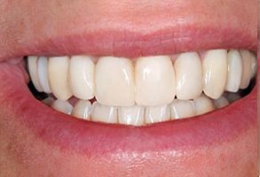Dental Aesthetics | Dental Cleanings, Dentures and Teeth Whitening