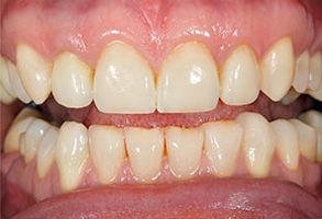 Dental Aesthetics | Cosmetic Dentistry, Dental Cleanings and Teeth Whitening