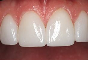 Dental Aesthetics | Laser Dentistry, Implant Dentistry and Dental Fillings
