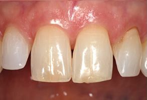 Dental Aesthetics | Implant Dentistry, Cosmetic Dentistry and Dental Fillings