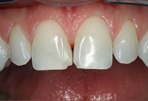 Dental Aesthetics | Oral Cancer Screening, Dental Fillings and Implant Dentistry